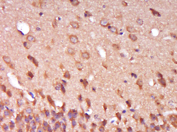 SPG11 Rabbit Polyclonal Antibody