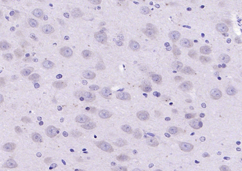 Phospho-SPHK2 (Thr614) Rabbit Polyclonal Antibody