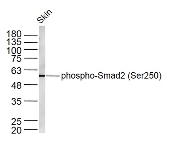 Phospho-Smad2 (Ser250) Rabbit Polyclonal Antibody