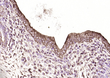 SAKS1/2B28 Rabbit Polyclonal Antibody