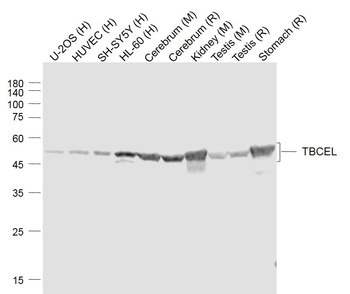 TBCEL Rabbit Polyclonal Antibody