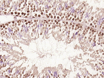 Tex14 Rabbit Polyclonal Antibody
