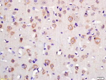 TSPAN12 Rabbit Polyclonal Antibody