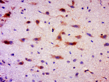 TRANK1 Rabbit Polyclonal Antibody
