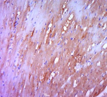TRAPPC5 Rabbit Polyclonal Antibody