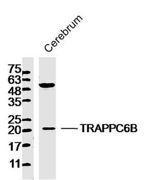 TRAPPC6B Rabbit Polyclonal Antibody