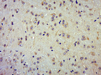 TRAPPCL2 Rabbit Polyclonal Antibody