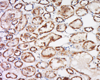 Trehalase Rabbit Polyclonal Antibody