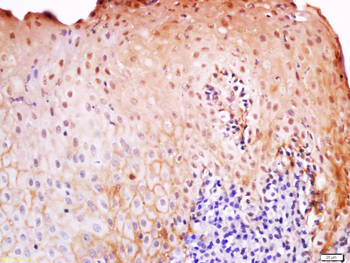 TENT4B Rabbit Polyclonal Antibody