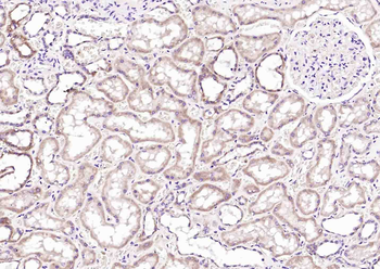 TRIM14 Rabbit Polyclonal Antibody