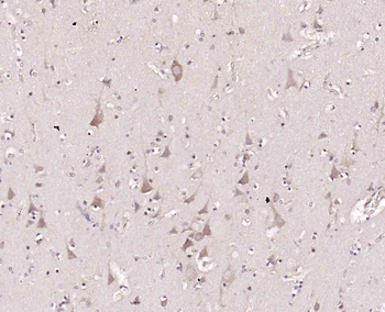 TRIM62 Rabbit Polyclonal Antibody