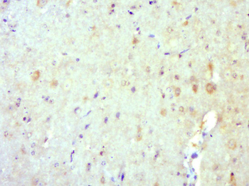 TRIM62 Rabbit Polyclonal Antibody