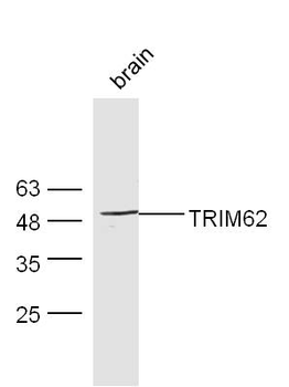 TRIM62 Rabbit Polyclonal Antibody