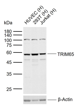 TRIM65 Rabbit Polyclonal Antibody