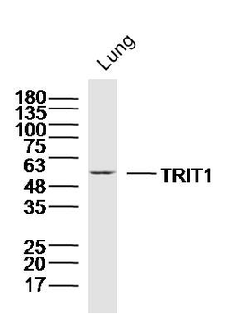 TRIT1 Rabbit Polyclonal Antibody