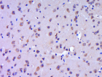TRIM9 Rabbit Polyclonal Antibody