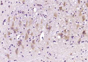 Tropomodulin 2 Rabbit Polyclonal Antibody