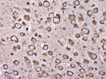 Tropomodulin 3 Rabbit Polyclonal Antibody