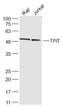 TPIT Rabbit Polyclonal Antibody