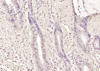 Topoisomerase II beta Rabbit Polyclonal Antibody