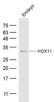 TCL3/HOX11 Rabbit Polyclonal Antibody