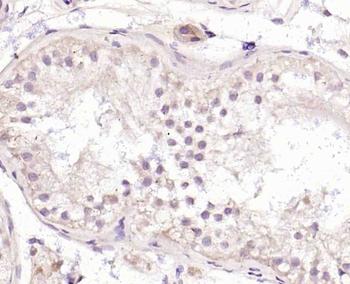 TET3 Rabbit Polyclonal Antibody