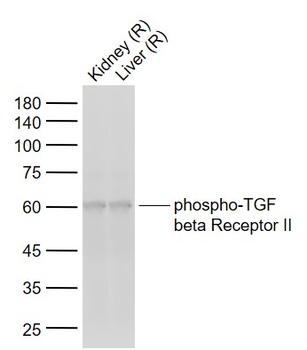 TGF beta Receptor II (phospho-Tyr336) antibody