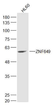 ZNF649 Rabbit Polyclonal Antibody