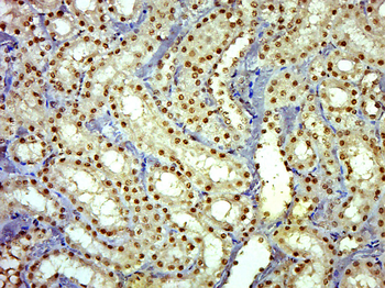 ZSWIM4 Rabbit Polyclonal Antibody