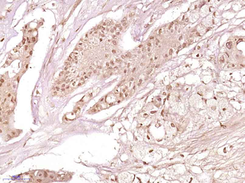 ZNF860 Rabbit Polyclonal Antibody