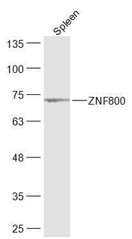 ZNF800 Rabbit Polyclonal Antibody