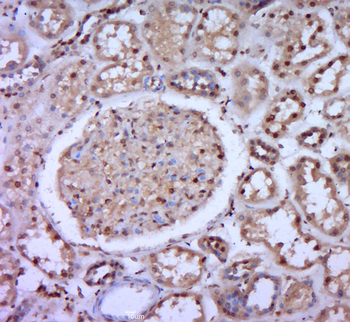 ZNF804B Rabbit Polyclonal Antibody