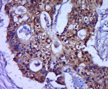 ZNF793 Rabbit Polyclonal Antibody