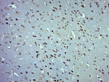 ZNF770 Rabbit Polyclonal Antibody