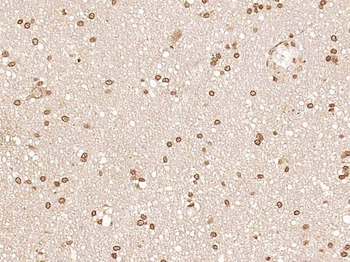 ZNF676 Rabbit Polyclonal Antibody
