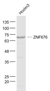 ZNF676 Rabbit Polyclonal Antibody