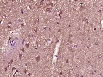 ZNF683 Rabbit Polyclonal Antibody