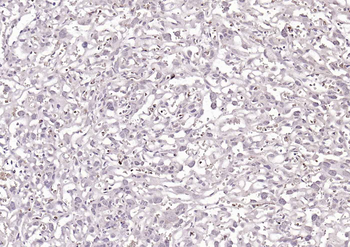 ZDHHC6 Rabbit Polyclonal Antibody