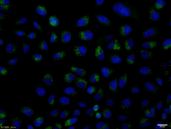 ZDHHC8 Rabbit Polyclonal Antibody