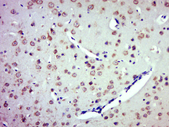 ZDHHC8 Rabbit Polyclonal Antibody