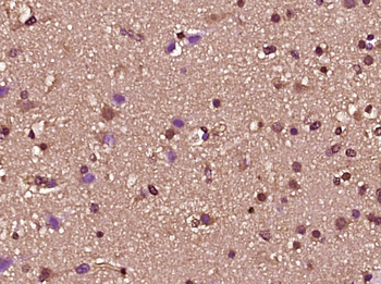 ZNF2 Rabbit Polyclonal Antibody