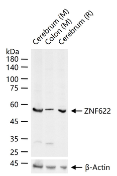 ZNF622 Rabbit Polyclonal Antibody