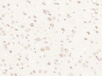 ZNF622 antibody