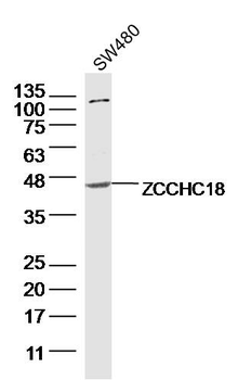 ZCCHC18 Rabbit Polyclonal Antibody