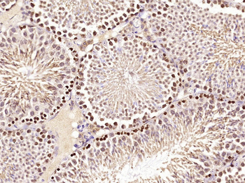 Zcrb1 Rabbit Polyclonal Antibody