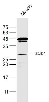 Zcrb1 Rabbit Polyclonal Antibody