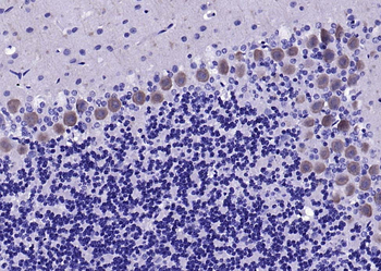 Neurotrophin 3 Rabbit Polyclonal Antibody