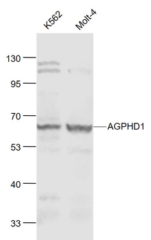 Hydroxylysine kinase Rabbit Polyclonal Antibody