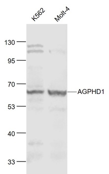 AGPHD1 antibody