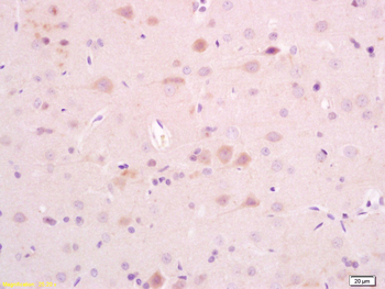 AKAP5 Rabbit Polyclonal Antibody